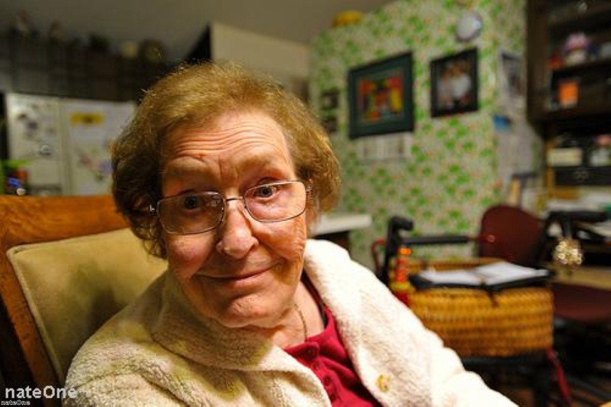 Aged-related eye conditions 'can be diagnosed earlier' Aged-related eye conditions 'can be diagnosed earlier'