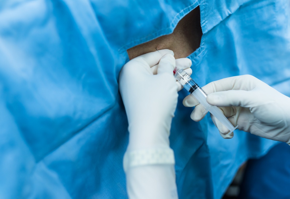 Lumbar puncture could replace questions in dementia diagnosis