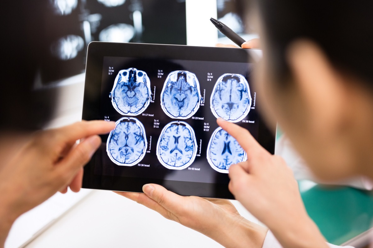 Alzheimer’s patients’ memories boosted with magnet zapping Alzheimer’s patients’ memories boosted with magnet zapping