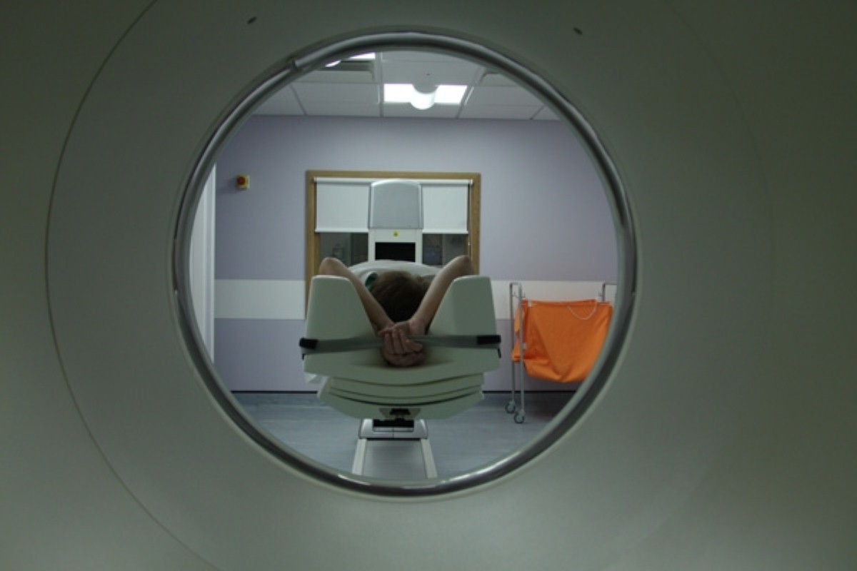 Brain scans can 'detect Alzheimer's disease effects' Brain scans can 'detect Alzheimer's disease effects'