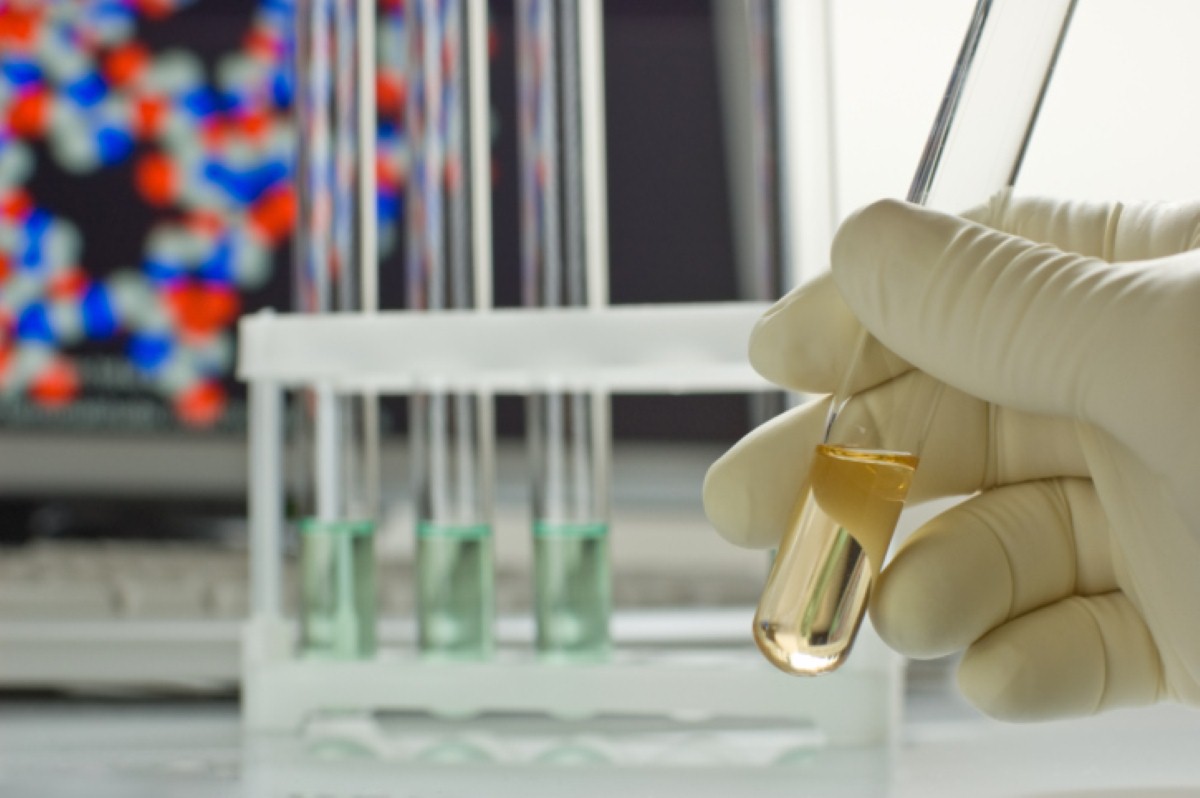 Brain breakthrough 'leads to new direction in Alzheimer's research' Brain breakthrough 'leads to new direction in Alzheimer's research'