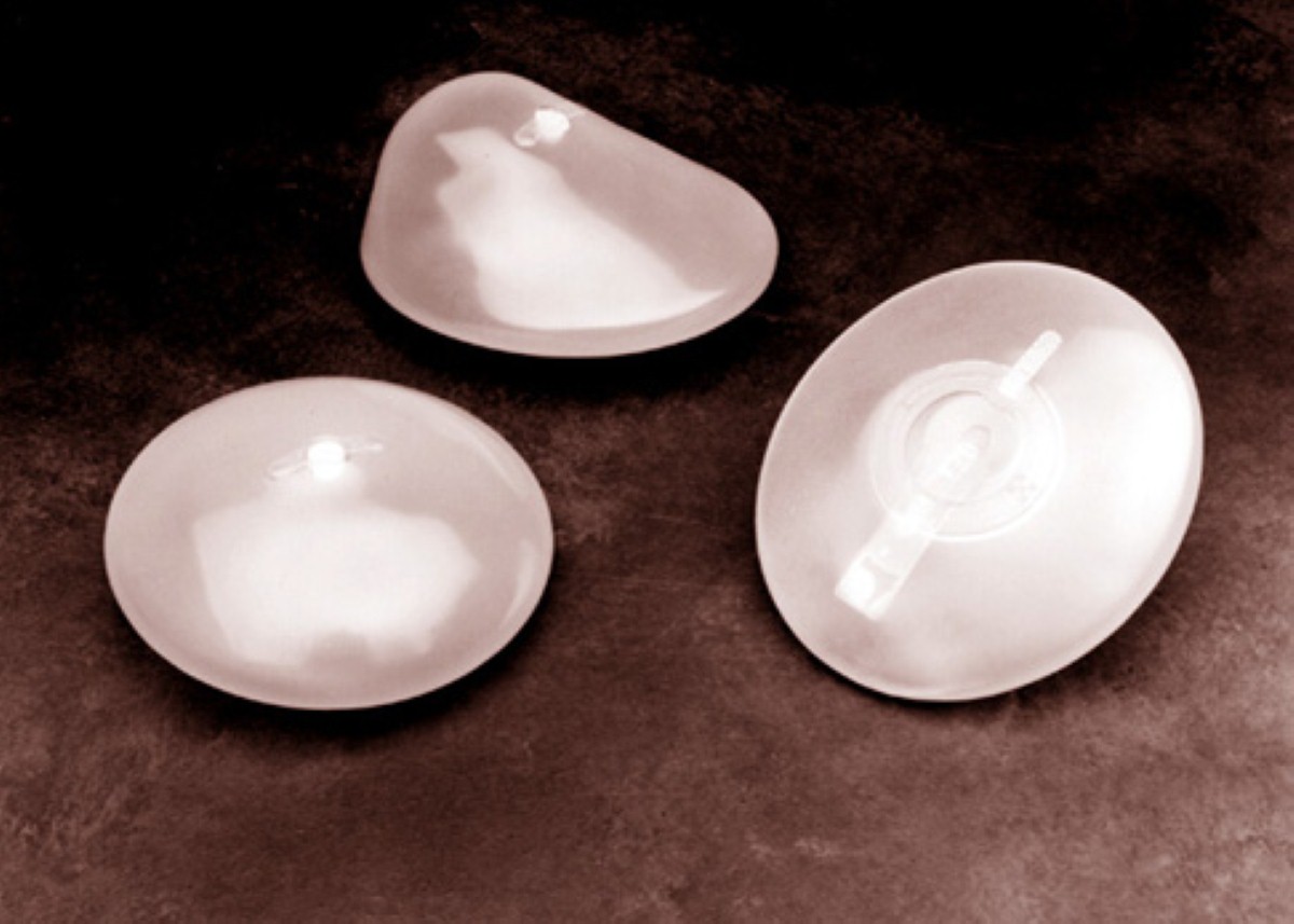 PIP breast implant data revealed by government Barchester Healthcare