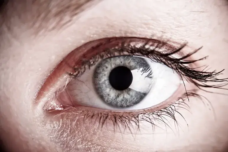 Could an eye test determine stroke risk?