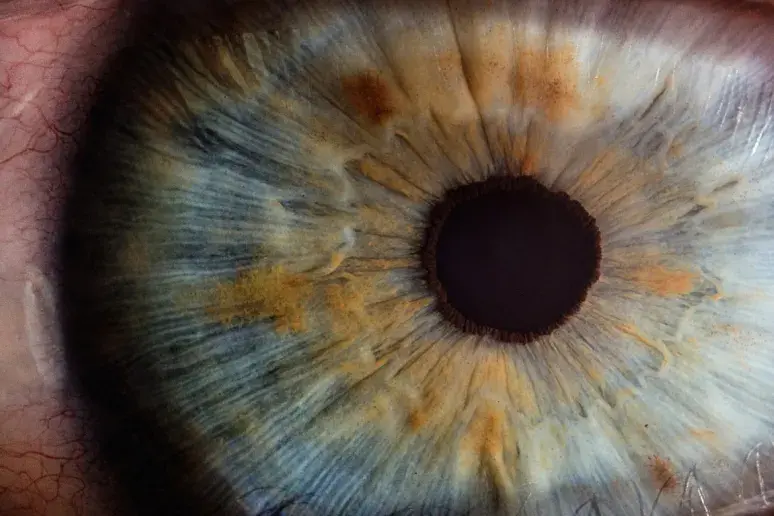 Scientists ‘could count blood vessels in the eye’ to spot dementia early
