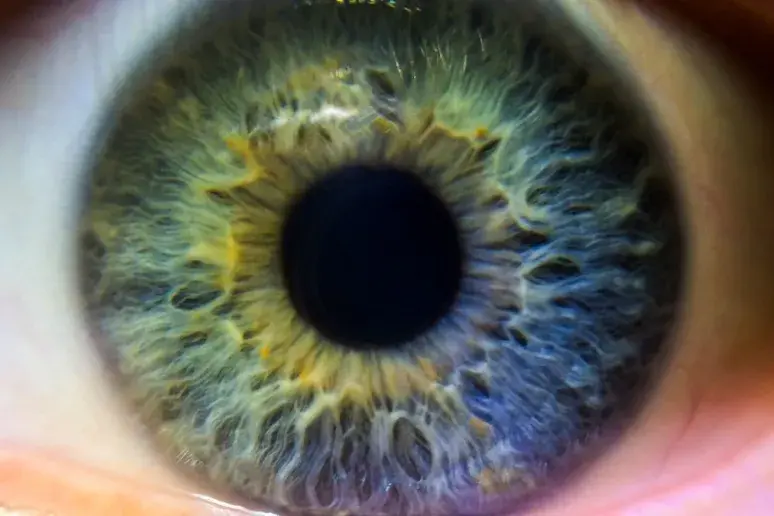 Eye damage could predict dementia risk, new study finds