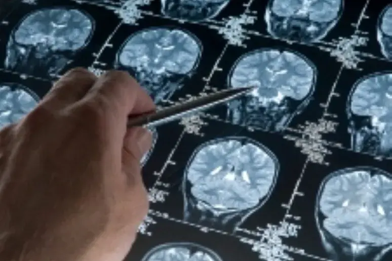 Brain pathways mapped in unprecedented detail