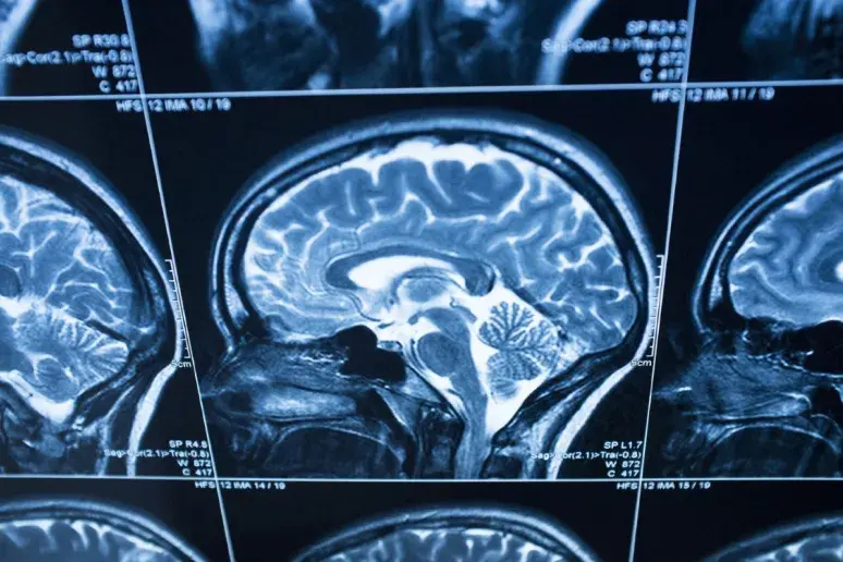Brains lose elasticity through ageing, study shows