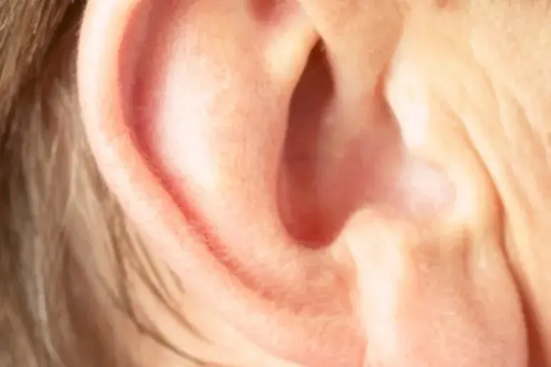 People should see audiologists 'early on'
