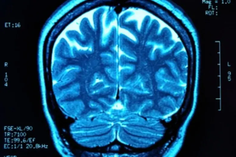 Brain anatomy 'could identify autistic individuals'