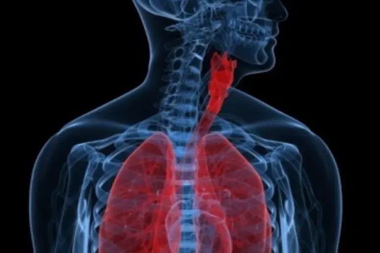 Cough warns of advanced idiopathic pulmonary fibrosis 