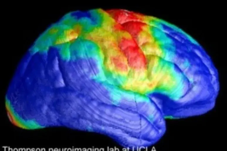 Neural decline mechanism that causes HIV-associated dementia identified