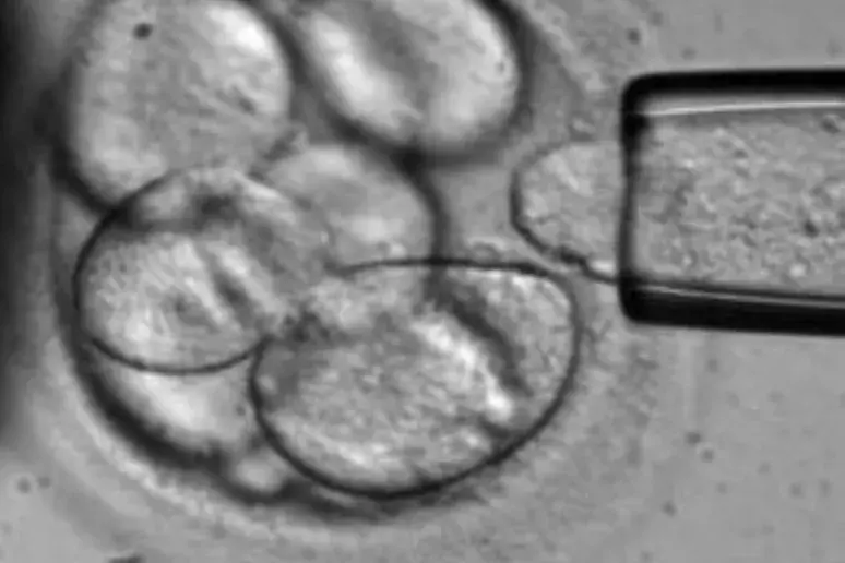 Stem cell model developed for hereditary disease