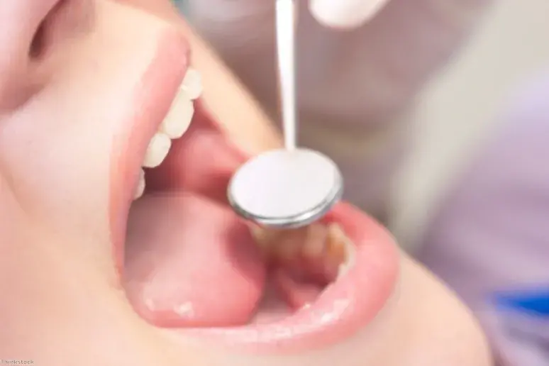 Oral hygiene linked to arthritis